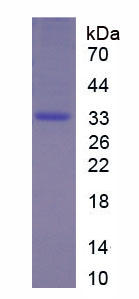 Recombinant 17-Beta-Hydroxysteroid Dehydrogenase Type 1 (HSD17b1)