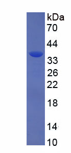 Recombinant 17-Beta-Hydroxysteroid Dehydrogenase Type 3 (HSD17b3)