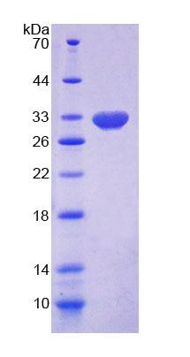 Recombinant 17-Beta-Hydroxysteroid Dehydrogenase Type 14 (HSD17b14)