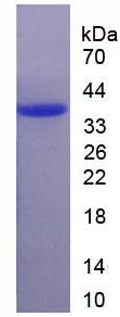 Recombinant 11-Beta-Hydroxysteroid Dehydrogenase Type 2 (HSD11b2)