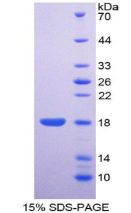 Recombinant Ectonucleotide Pyrophosphatase/Phosphodiesterase 1 (ENPP1)