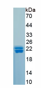 Recombinant Calcium Channel, Voltage Dependent, N-Type, Alpha 1B Subunit (CACNa1B)