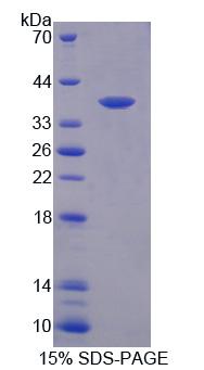 Recombinant Centrosomal Protein 55kDa (CEP55)