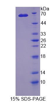 Recombinant Cytokine Receptor Like Factor 1 (CRLF1)