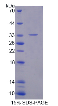 Recombinant Cytokine Receptor Like Factor 1 (CRLF1)