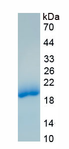 Recombinant Cellular Retinoic Acid Binding Protein 2 (CRABP2)