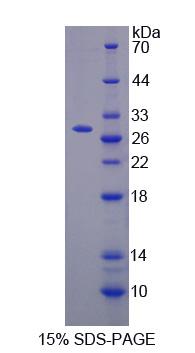 Recombinant Cysteine Rich Secretory Protein 3 (CRISP3)