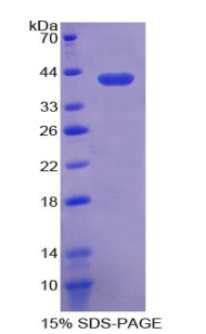 Recombinant Crystallin Lambda 1 (CRYl1)