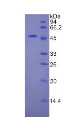 Recombinant Carnitine Palmitoyltransferase 1A, Liver (CPT1A)