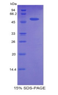 Recombinant Carnitine Palmitoyltransferase 1A, Liver (CPT1A)