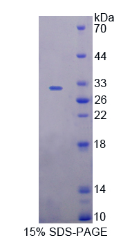 Recombinant Docking Protein 7 (DOK7)