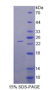Recombinant Dipeptidase 2 (DPEP2)