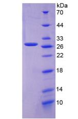 Recombinant Folate Receptor 1, Adult (FOLR1)