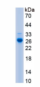 Recombinant Folate Receptor 1, Adult (FOLR1)