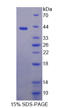 Recombinant Centaurin Alpha 2 (CENTa2)