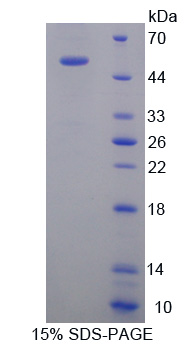 Recombinant Kinesin Family, Member 18A (KIF18A)