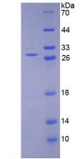 Recombinant Lysyl Oxidase Like Protein 1 (LOXL1)