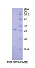 Recombinant Lysyl Oxidase Like Protein 2 (LOXL2)