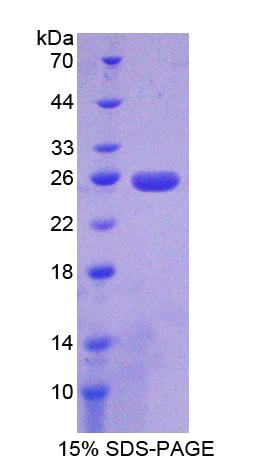 Recombinant Uroplakin 3A (UPK3A)
