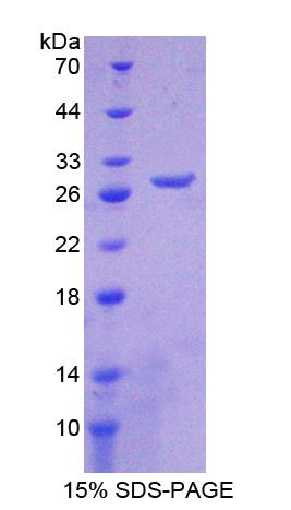 Recombinant Chordin Like Protein 1 (CHRDL1)