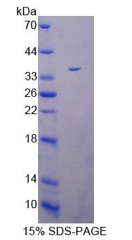 Recombinant Peptidyl Arginine Deiminase Type IV (PADI4)