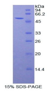 Recombinant Peroxiredoxin 6 (PRDX6)