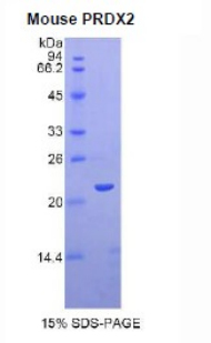 Recombinant Peroxiredoxin 2 (PRDX2)