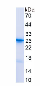 Recombinant Transgelin 2 (TAGLN2)