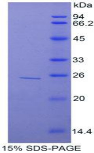 Recombinant Tumor Necrosis Factor Alpha Induced Protein 3 Interacting Protein 2 (TNIP2)