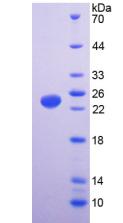 Recombinant Transient Receptor Potential Cation Channel Subfamily V, Member 1 (TRPV1)