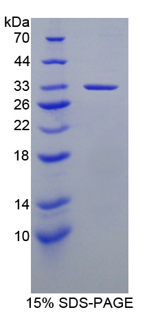 Recombinant Transient Receptor Potential Cation Channel Subfamily V, Member 2 (TRPV2)