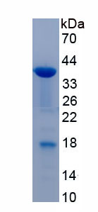 Recombinant Secretogranin II (SCG2)