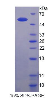 Recombinant Sestrin 1 (SESN1)