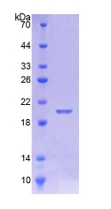 Recombinant Calmodulin Like Protein 5 (CALML5)