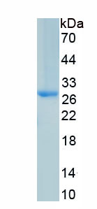 Recombinant Sclerostin Domain Containing Protein 1 (SOSTDC1)