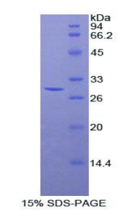 Recombinant Stanniocalcin 2 (STC2)