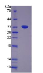 Recombinant Utrophin (UTRN)