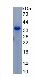 Recombinant Reticulon 4 (RTN4)