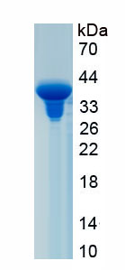 Recombinant G Protein Coupled Estrogen Receptor 1 (GPER)