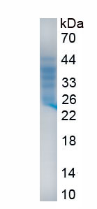 Recombinant G Protein Coupled Estrogen Receptor 1 (GPER)