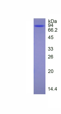 Recombinant Leucyl tRNA Synthetase 2, Mitochondrial (LARS2)