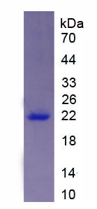 Recombinant Advillin (AVIL)