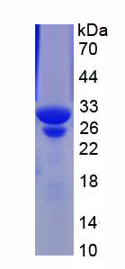 Recombinant Proteasome Subunit Alpha Type 6 (PSMa6)