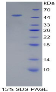 Recombinant Proteasome 26S Subunit, ATPase 6 (PSMC6)