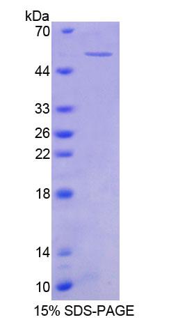 Recombinant Nephroblastoma Overexpressed Gene (NOV)