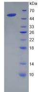 Recombinant Corin (CRN)