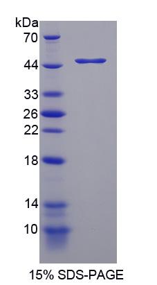 Recombinant Tryptophan Hydroxylase 2 (TPH2)