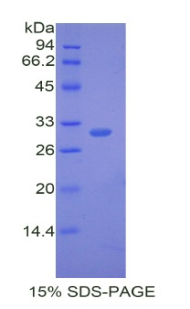 Recombinant ATPase, Na+/K+ Transporting Beta 1 Polypeptide (ATP1b1)