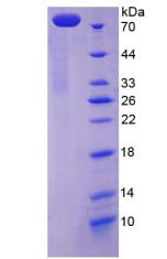 Recombinant ATPase, Ca++ Transporting, Cardiac Muscle, Slow Twitch 2 (ATP2A2)