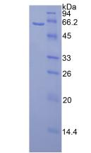 Recombinant Calbindin (CALB)